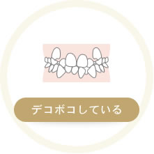 デコボコしている