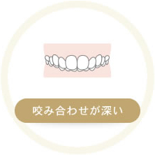 噛み合わせが深い